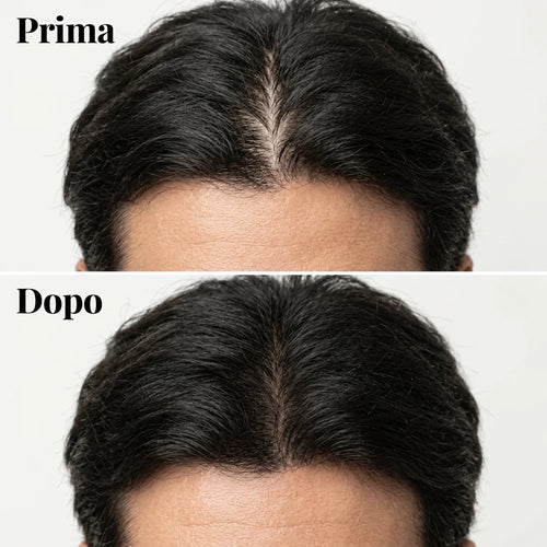 Shampoo Solido Anticaduta Coreano