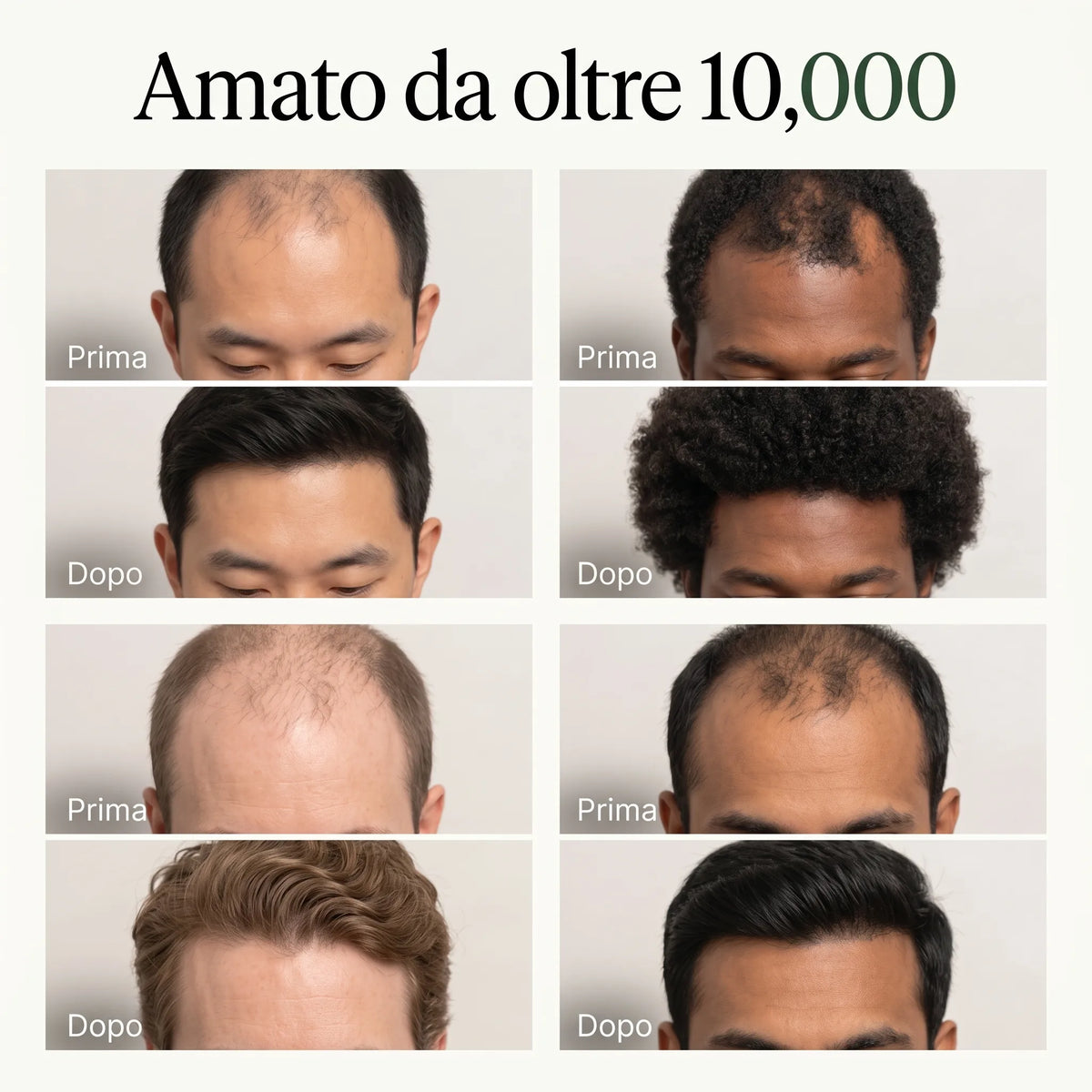 Shampoo Solido Anticaduta Coreano